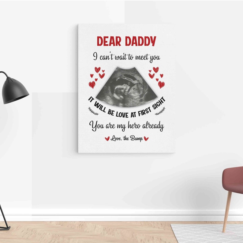 Personalized Ultrasound Canvas, Baby Ultrasound Picture Sonogram, Baby